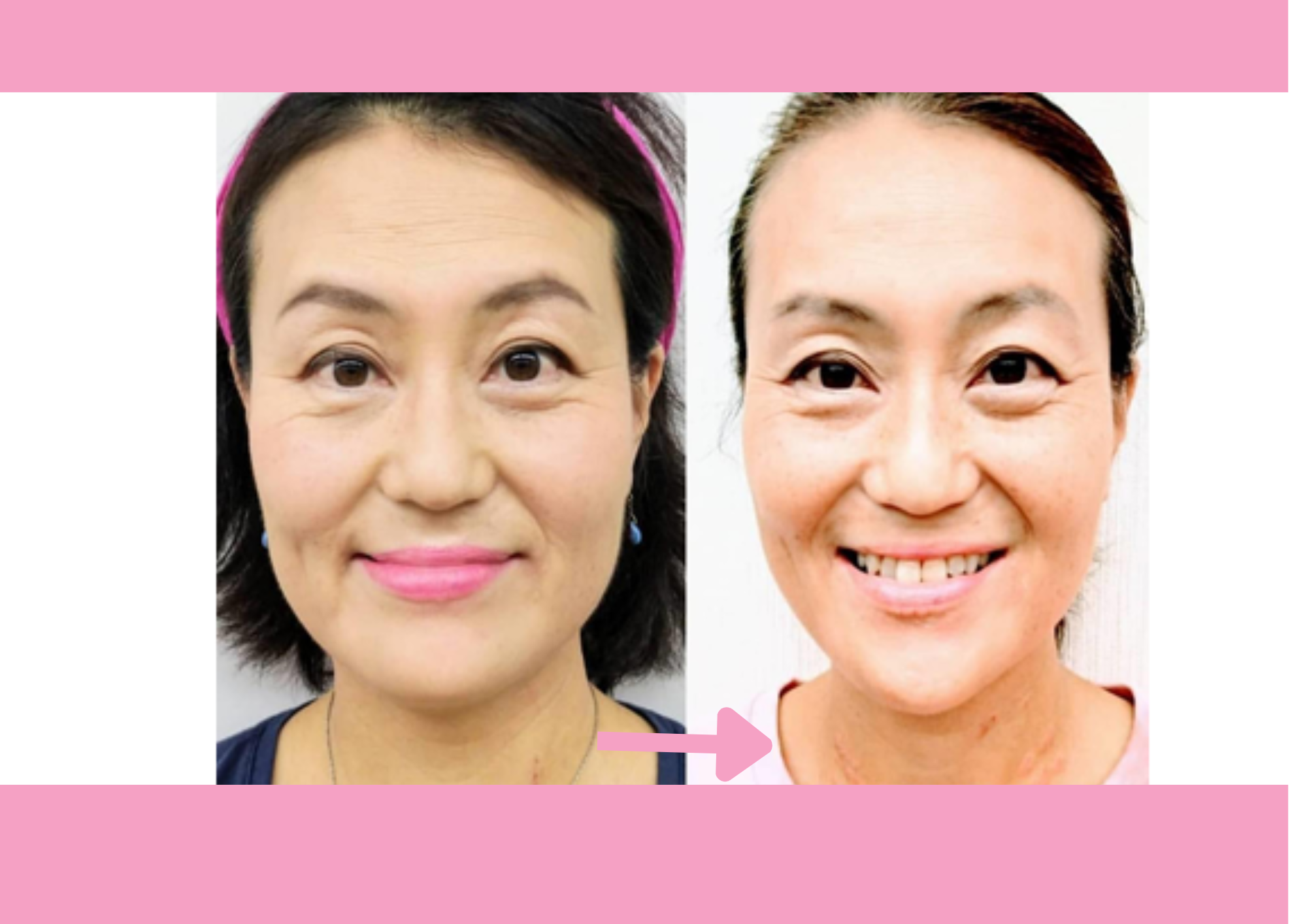 お顔の筋肉を動かして若々しさと健康・活力を取り戻そう ～年齢を重ねても毎日を楽しく過ごす体作り～【11:00~】